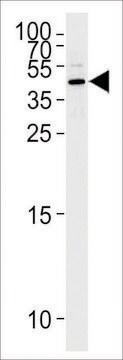 ANTI-MASPIN (CENTER) antibody produced in rabbit affinity isolated antibody, buffered aqueous solution