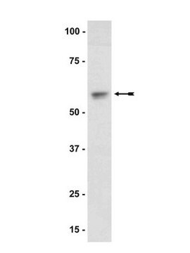 Anti-Akt1/PKB&#945; Antibody Upstate&#174;, from rabbit