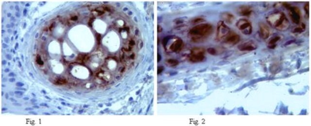 Anti-Aggrecan Antibody, clone 1-C-6 clone 1-C-6, from mouse