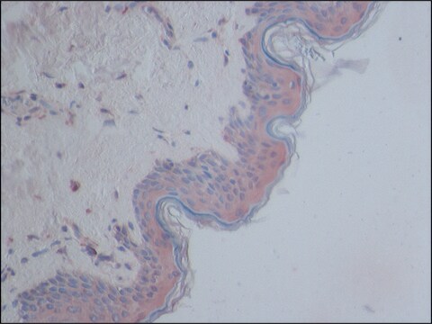 Anti-CYLD antibody produced in rabbit ~1.0&#160;mg/mL, affinity isolated antibody, buffered aqueous solution