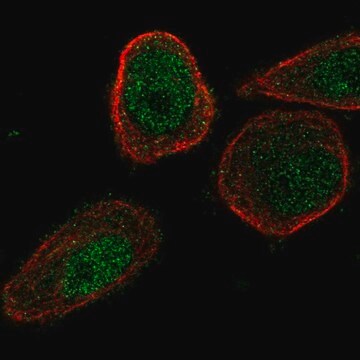 Anti-CHML antibody produced in rabbit Prestige Antibodies&#174; Powered by Atlas Antibodies, affinity isolated antibody, buffered aqueous glycerol solution