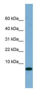 Anti-FABP1 (N-terminal) antibody produced in rabbit affinity isolated antibody