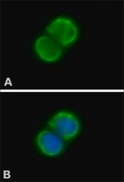 Anti-PARP antibody produced in rabbit affinity isolated antibody, buffered aqueous solution