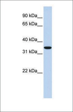 Anti-MARCH1 antibody produced in rabbit affinity isolated antibody