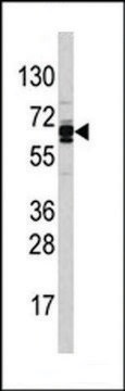 ANTI-USP21(N-TERMINAL) antibody produced in rabbit IgG fraction of antiserum, buffered aqueous solution