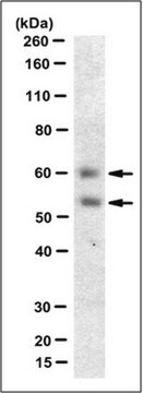 Anti-Myocilin-(NT-)Antikörper, Klon&nbsp;7.1 clone 7.1, from mouse