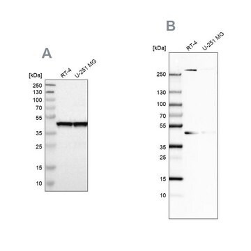 Anti-SMARCB1 antibody produced in rabbit Prestige Antibodies&#174; Powered by Atlas Antibodies, affinity isolated antibody, buffered aqueous glycerol solution