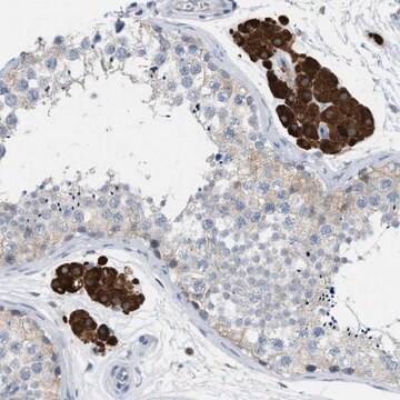 Anti-PPM1D antibody produced in rabbit Prestige Antibodies&#174; Powered by Atlas Antibodies, affinity isolated antibody, buffered aqueous glycerol solution