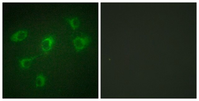 Anti-TGF &#946; Receptor III antibody produced in rabbit affinity isolated antibody