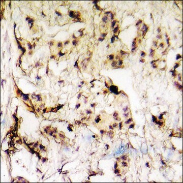 Anti-phospho-hnRNP K (pSer284) antibody produced in rabbit affinity isolated antibody