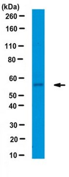 Anticorpo anti-IFIT1/p56 serum, from rabbit