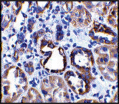 Anti-ACE2 antibody produced in rabbit affinity isolated antibody