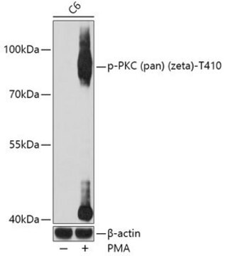 Anti-Phospho-PKC (pan) (zeta)-T410 antibody produced in rabbit