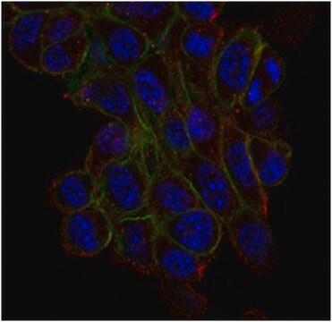 Anti-Trpv4 Antibody, clone 1B2.6 clone 1B2.6, from mouse