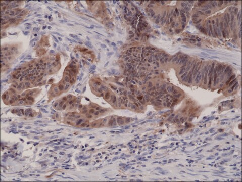 抗- p16ink4a（CDKN2A）抗体，兔单克隆 recombinant, expressed in HEK 293 cells, clone RM267, purified immunoglobulin