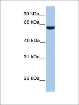 Anti-PHF1 (AB1) antibody produced in rabbit affinity isolated antibody