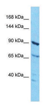 Anti-ABCF1 (N-terminal) antibody produced in rabbit affinity isolated antibody