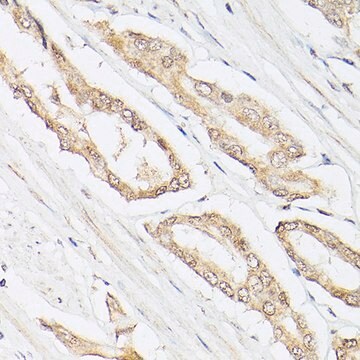 Anti-Pan Lactic acid-Lysine antibody produced in rabbit