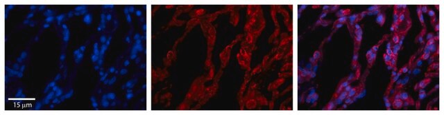 抗TAP1抗体 ウサギ宿主抗体 affinity isolated antibody