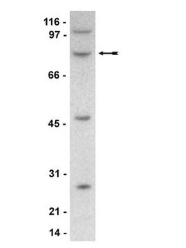 Anti-SETA/CIN85/Ruk/SH3KBPI Antibody, clone 84 clone 84, Upstate&#174;, from mouse