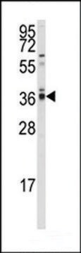 ANTI-PP2A ALPHA(N-TERMINAL) antibody produced in rabbit purified immunoglobulin, buffered aqueous solution