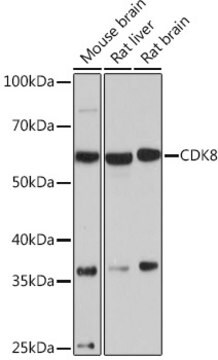 Anti-CDK8 Antibody, clone 7L5X2, Rabbit Monoclonal