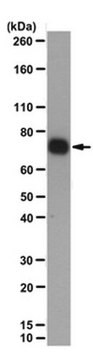 Anti-LIMD1-Antikörper, Klon&nbsp;3F2/C6 clone 3F2/C6, from mouse