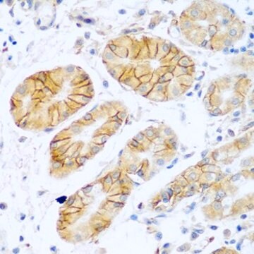 Anti-NCAM1/CD56 antibody produced in rabbit