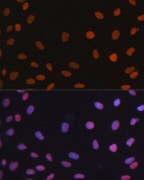 Anti-RB antibody produced in rabbit