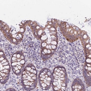 抗RNF170抗体 ウサギ宿主抗体 Prestige Antibodies&#174; Powered by Atlas Antibodies, affinity isolated antibody, buffered aqueous glycerol solution