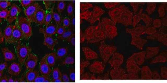 Anti-E2F-7 Antibody, clone 14C3.2 clone 14C3.2, from mouse