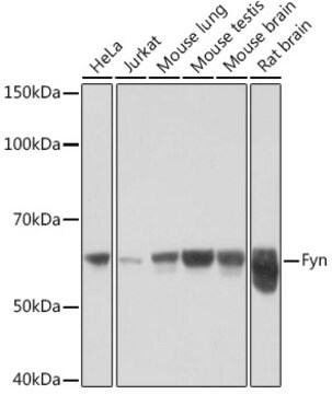 Anti-Fyn Antibody, clone 7Z9F2, Rabbit Monoclonal