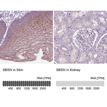 Anti-SBSN antibody produced in rabbit Prestige Antibodies&#174; Powered by Atlas Antibodies, affinity isolated antibody, buffered aqueous glycerol solution