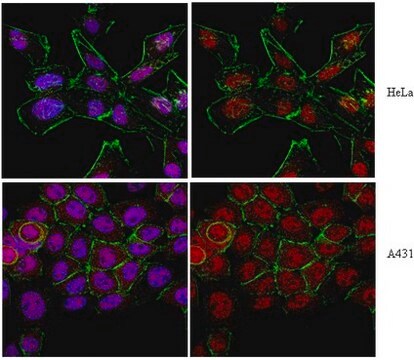 Anti-Axin-1 Antibody from rabbit, purified by affinity chromatography