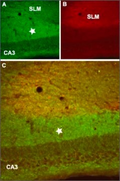 Anti-GABAB Receptor 2 ウサギ宿主抗体 affinity isolated antibody, lyophilized powder