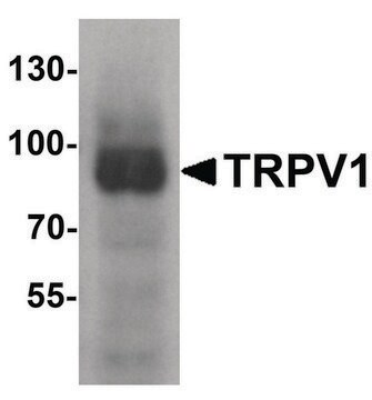 抗-TRPV1 兔抗 affinity isolated antibody