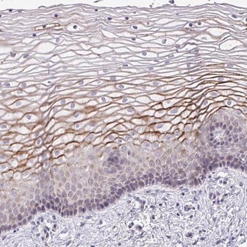 抗SUSD4抗体 ウサギ宿主抗体 Prestige Antibodies&#174; Powered by Atlas Antibodies, affinity isolated antibody, buffered aqueous glycerol solution