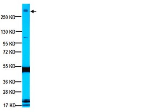 抗-MAP2A抗体，AP20 ascites fluid, clone AP20, Chemicon&#174;