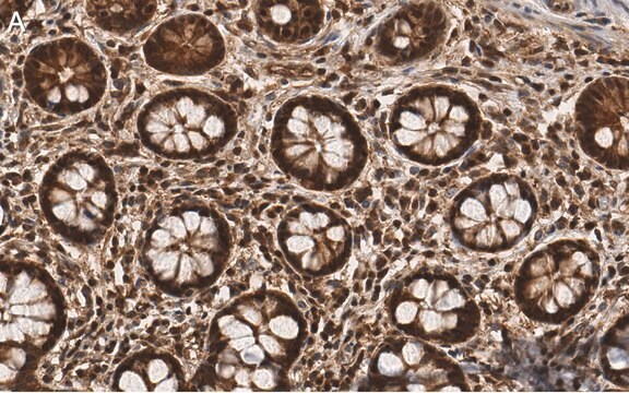 抗PSMB2抗体 クローン2N18 ZooMAb&#174;ウサギモノクローナル recombinant, expressed in HEK 293 cells