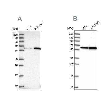 Anti-KPNA4 antibody produced in rabbit Prestige Antibodies&#174; Powered by Atlas Antibodies, affinity isolated antibody, buffered aqueous glycerol solution