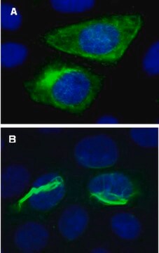 Biosensor lentiwirusowy LentiBrite GFP-Vimentin