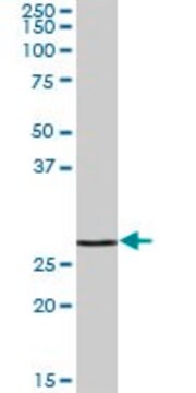 Anti-GAMT antibody produced in mouse purified immunoglobulin, buffered aqueous solution