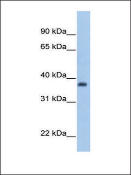 Anti-ST3GAL2 antibody produced in rabbit affinity isolated antibody