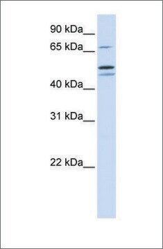 Anti-EARS2 antibody produced in rabbit affinity isolated antibody