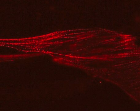 Biosensor lentiwirusowy LentiBrite α-aktynina-RFP