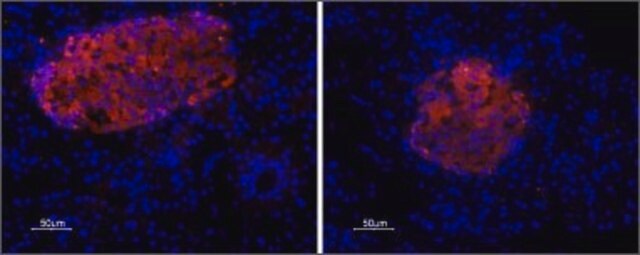 抗P2X7レセプター抗体 ウサギ宿主抗体 affinity isolated antibody, lyophilized powder