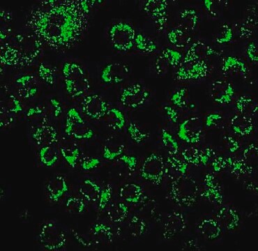 Colorant vert de l'hypoxie BioTracker&nbsp;520 Live cell imaging dye for hypoxia that increases in fluorescence intensity with decreasing oxygen levels.