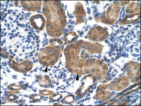 Anti-GRIK2 (AB2) antibody produced in rabbit IgG fraction of antiserum