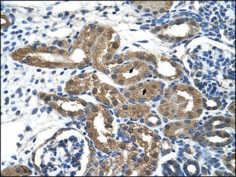 Anti-HDAC9 antibody produced in rabbit IgG fraction of antiserum