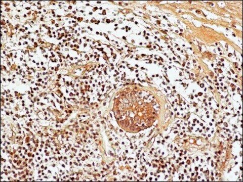 Anti-acetyl-Histone H3 (Ac-Lys27) antibody produced in rabbit ~1.0&#160;mg/mL, affinity isolated antibody